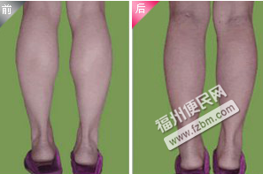 1428045805JYExXxhH.png